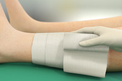 Person fikserer Sorbact Absorption-bandage med et fikseringsbind om benet.
