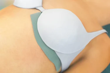 Person med bh med Sorbact Fungi-bandage placeret under brystet mellem huden og bh’en.